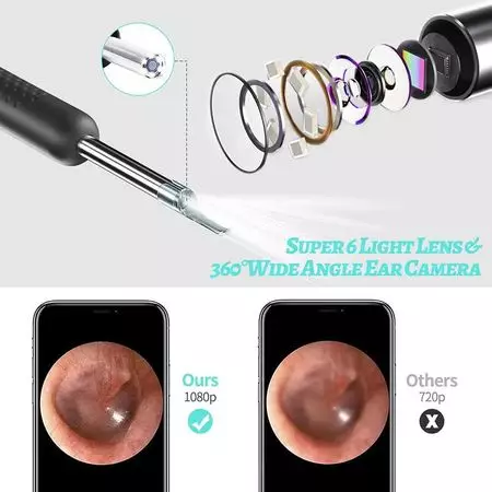 Xiaomi Bebird R1 Wireless Smart Visual Ear Cleaning Endoscope