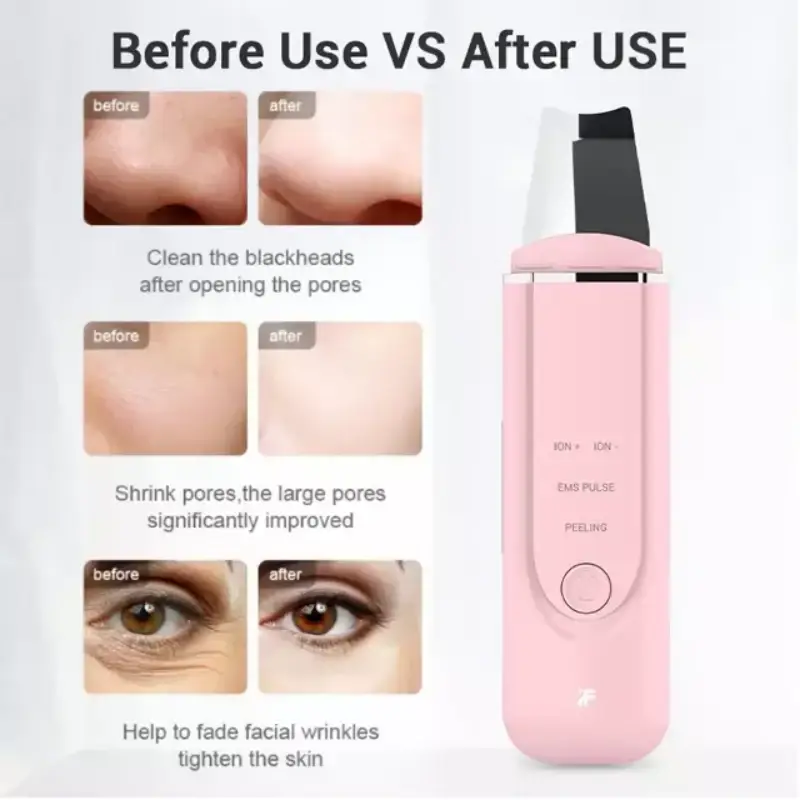 Xiaomi inFace MS7100 Ultrasonic Ionic Facial Cleaner
