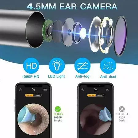 Xiaomi Bebird R1 Wireless Smart Visual Ear Cleaning Endoscope