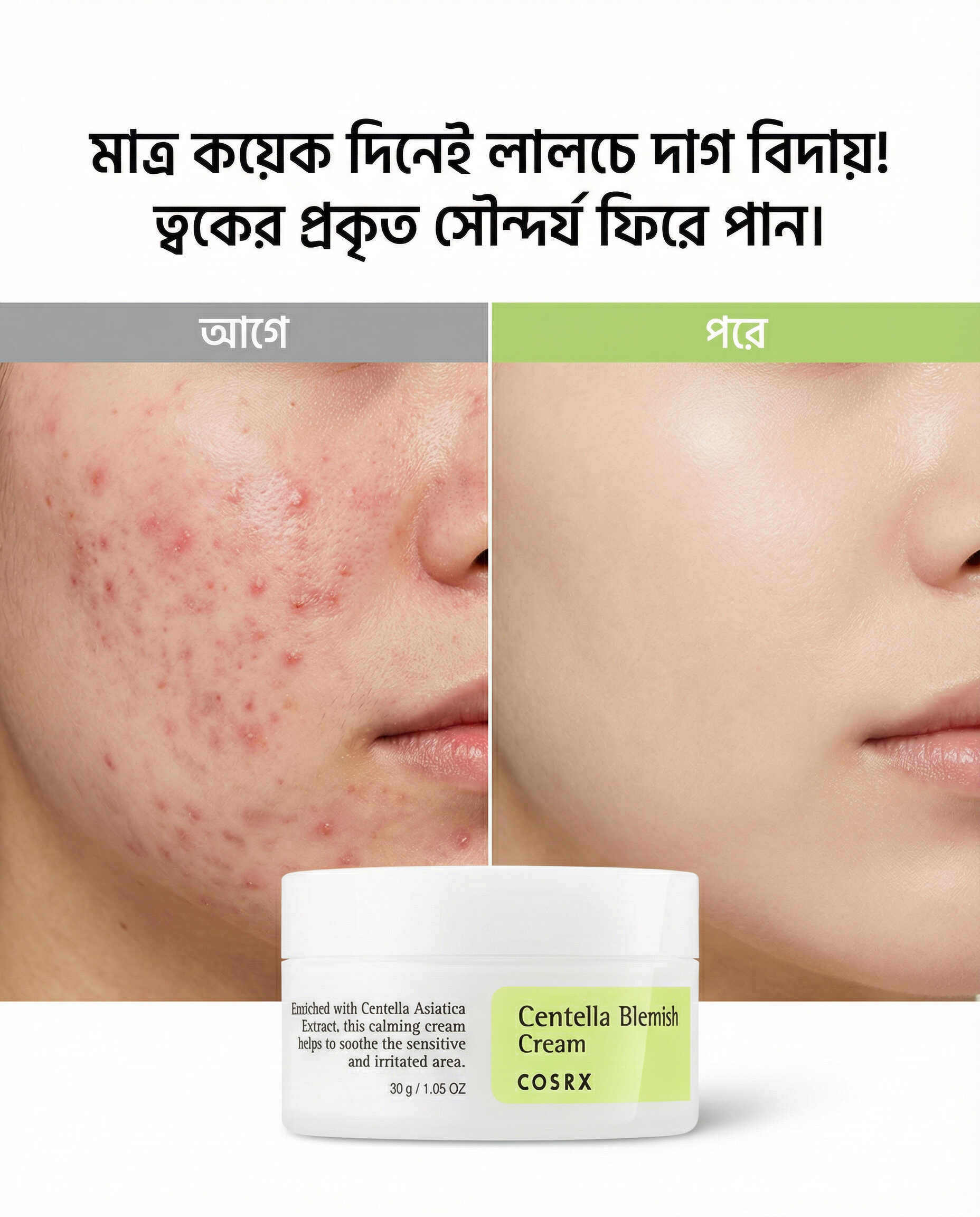 COSRX Centella Blemish Cream (30g)