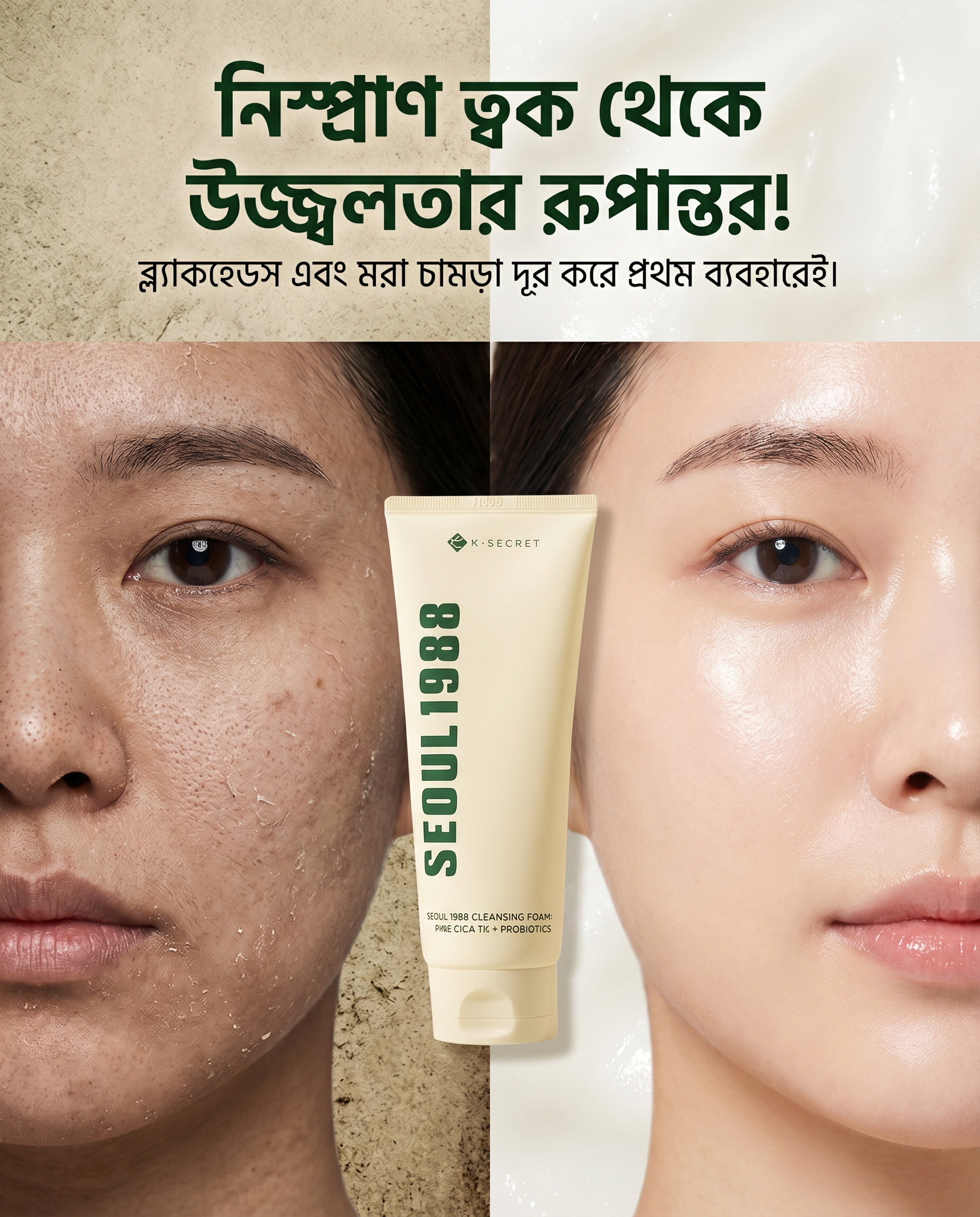 SEOUL 1988 Cleansing Foam (Pine Cica + Probiotics)