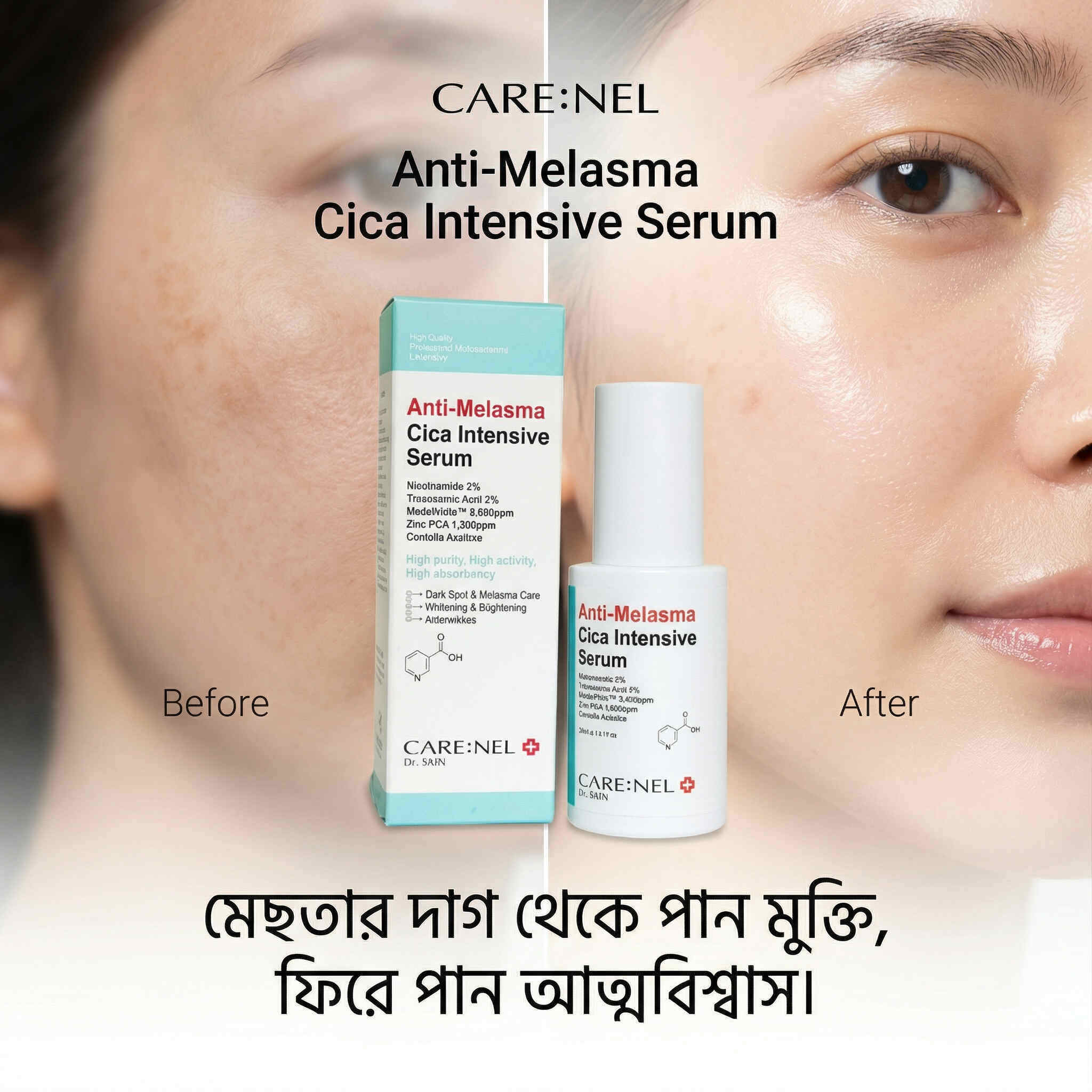 CARENEL Anti-Melasma Cica Intensive Serum