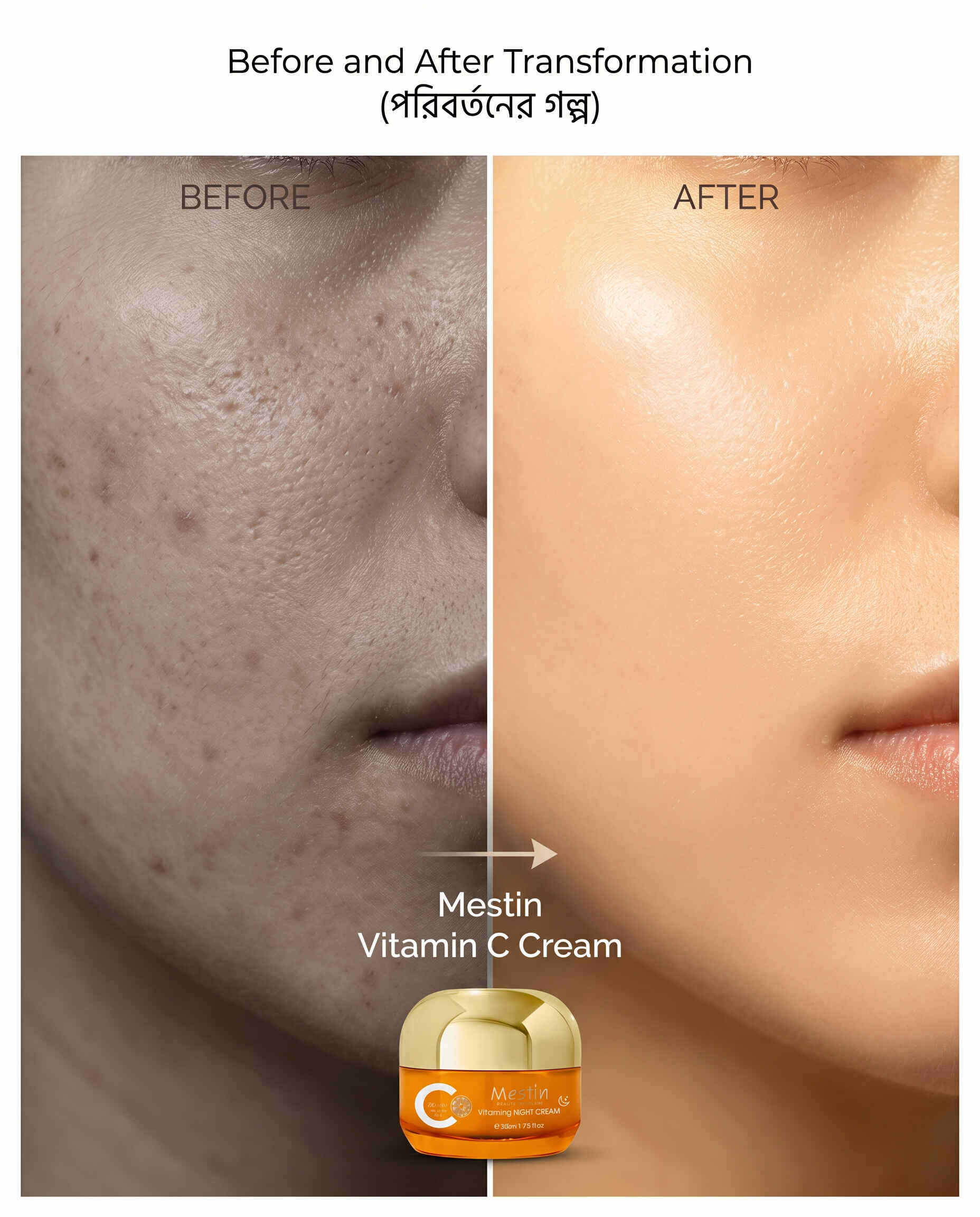 Mestin Vitamin C Hyaluronic Acid Whitening Cream